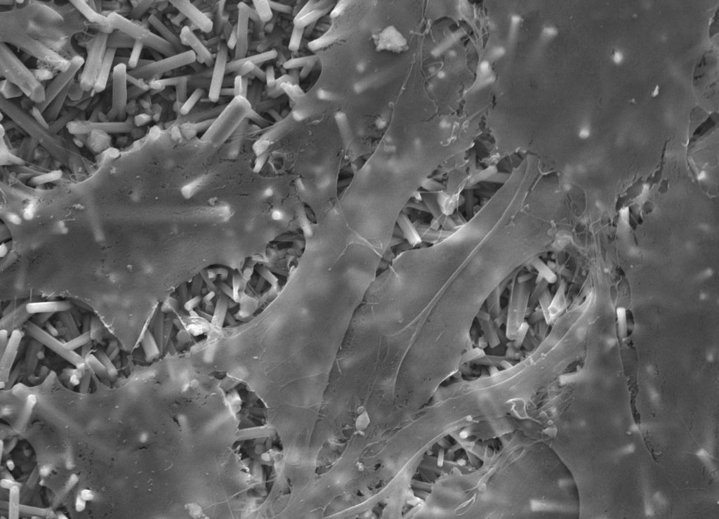 Bone cells on SiN ceramic