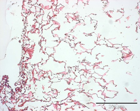 500mu boundary in chitosan scaffold HE